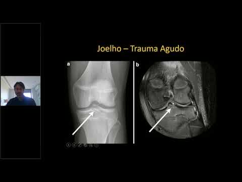 Ressonância Magnética